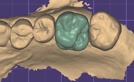 Case 1
