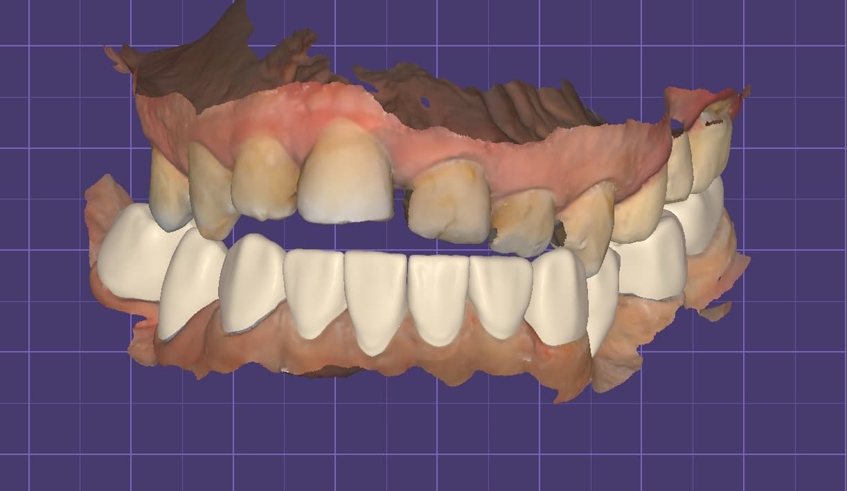 Case 4